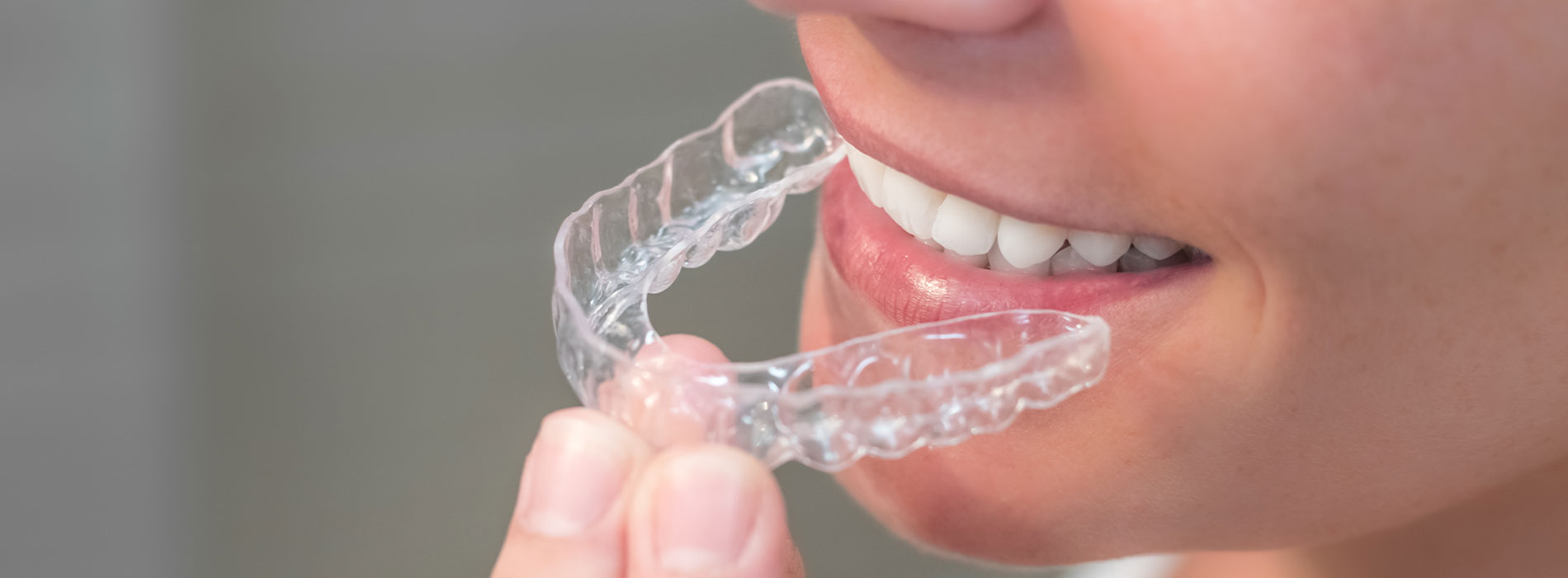The image shows a close-up of a person using a clear dental retainer with their teeth.